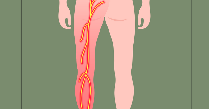 Chiropractic Care and Sciatic Pain: What the Latest Research Shows